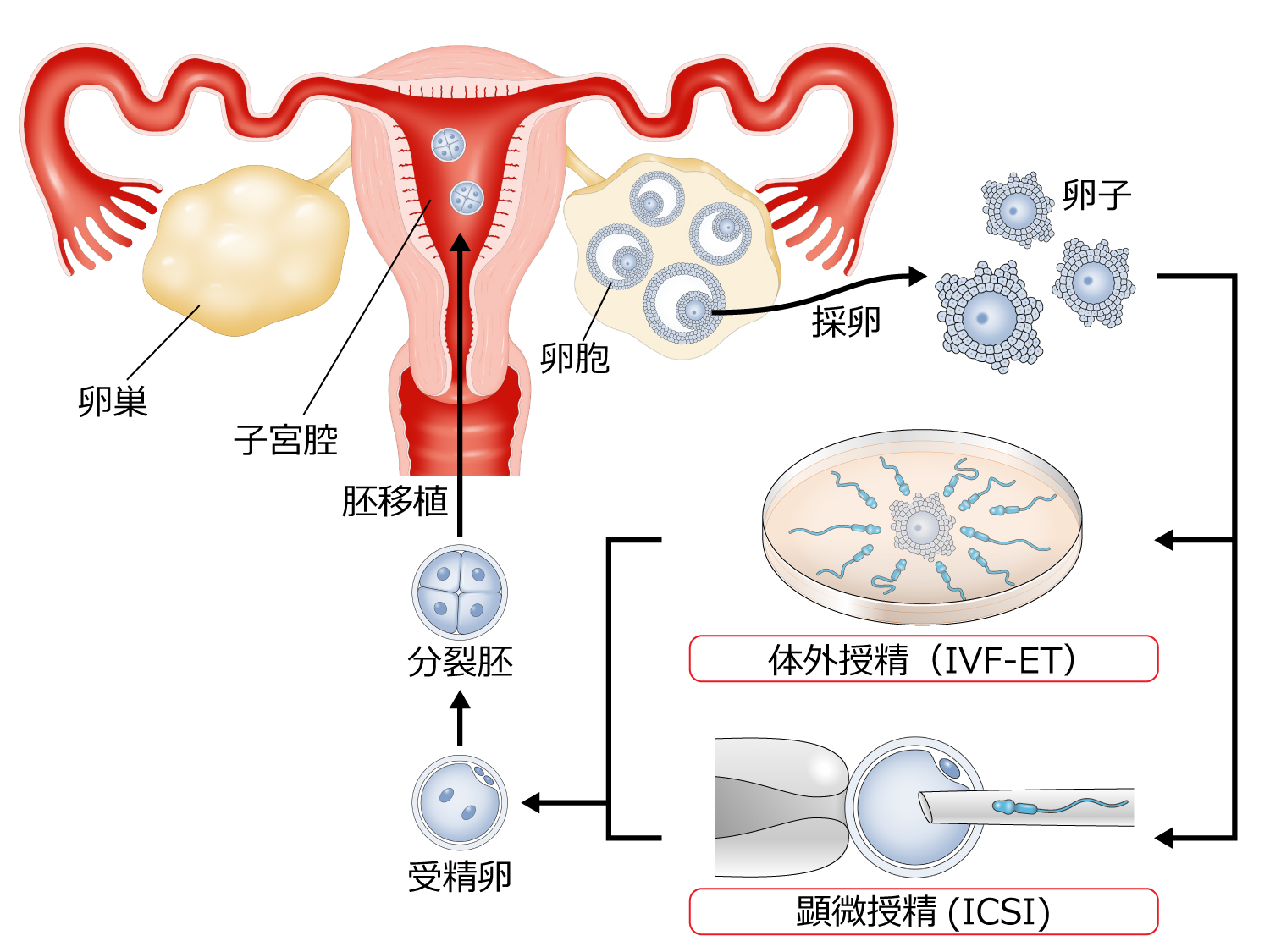 採卵から胚移植までの説明図