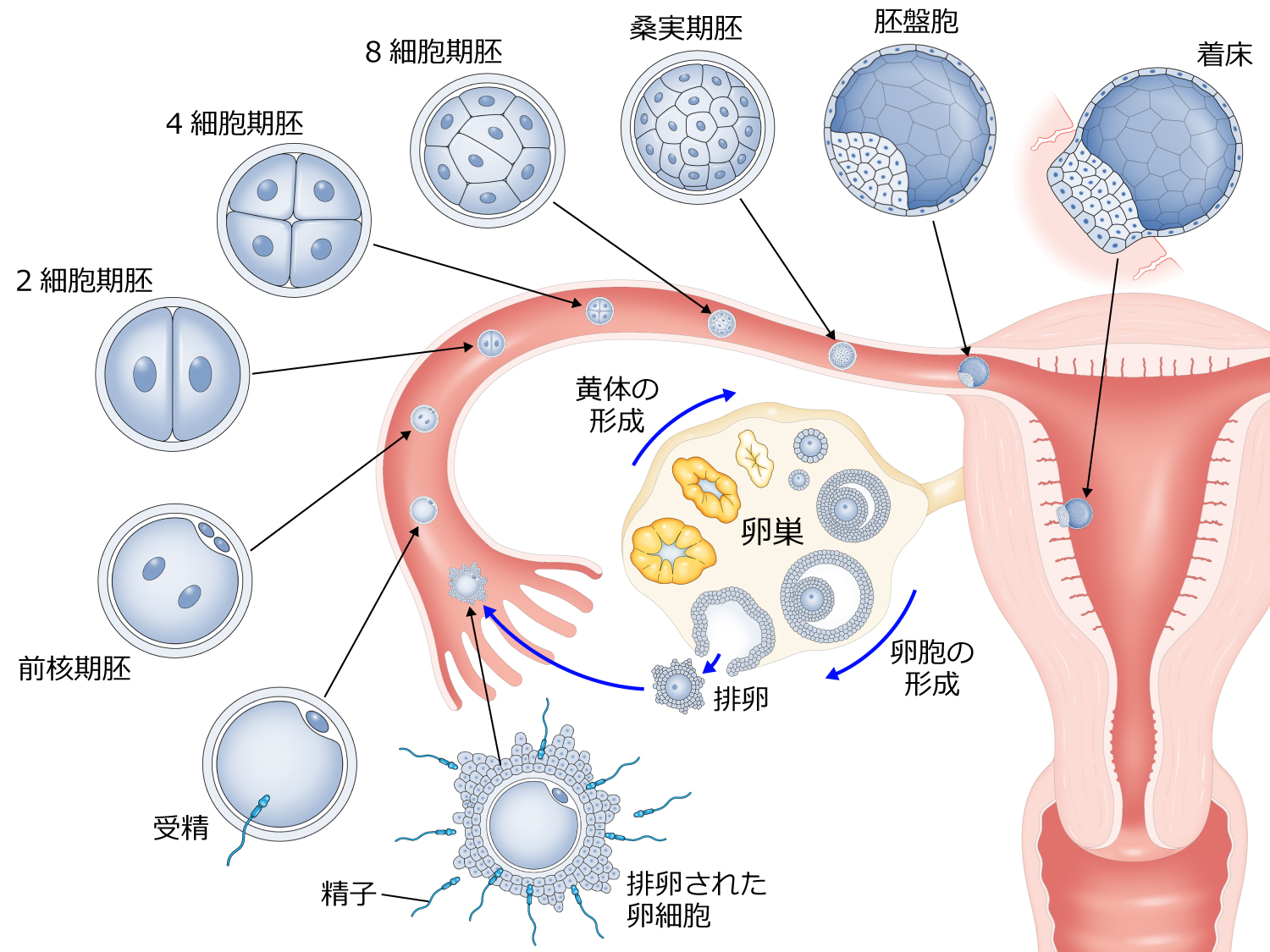 女性の不妊手術にはどのようなリスクがありますか?